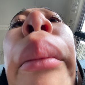 Meet your Posher, Anderson